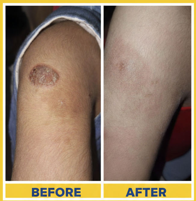 Al Arsh & ASB Complete Allergy Care Combo | Anti Allergy Cream + Anti Allergy Lotion + Anti Fungal Bodywash